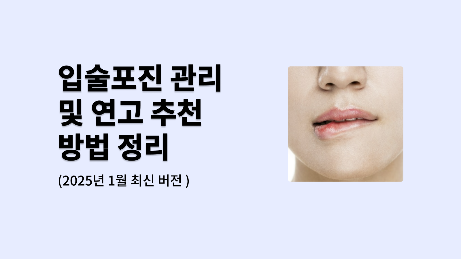 입술포진 관리 및 연고 추천 방법 정리